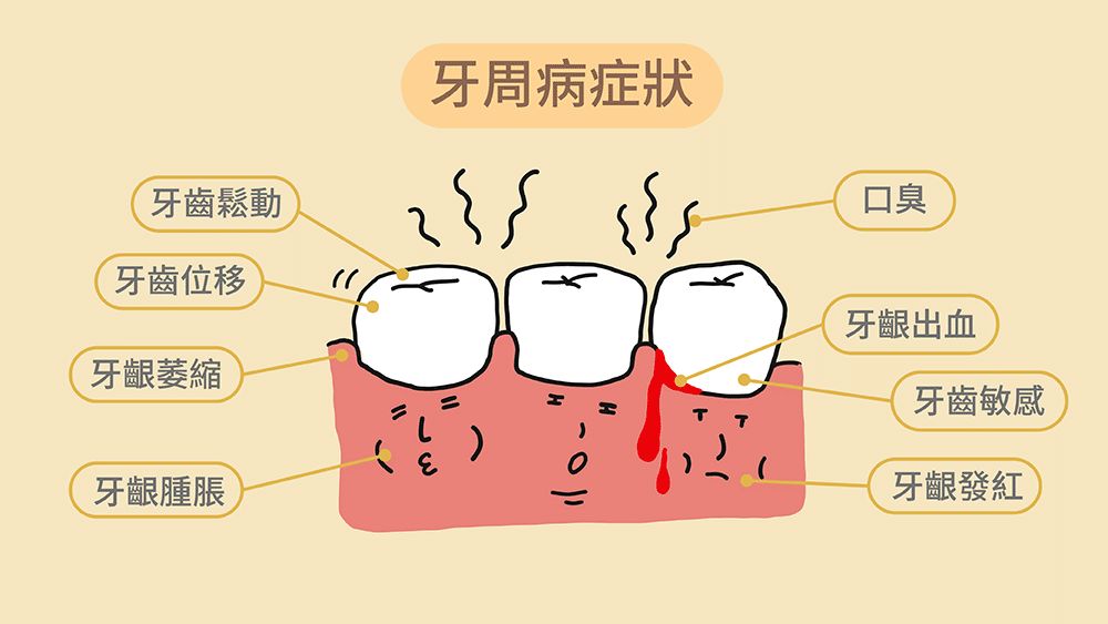 牙周病概述、预防与下载资源的重要性