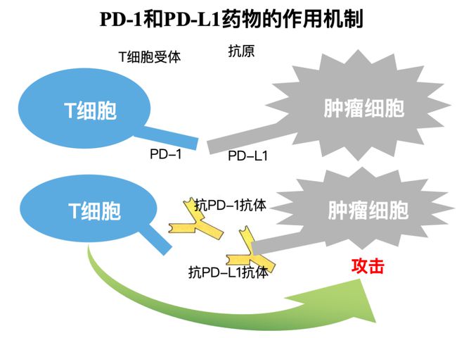 间质瘤最新临床试验新药研究概览